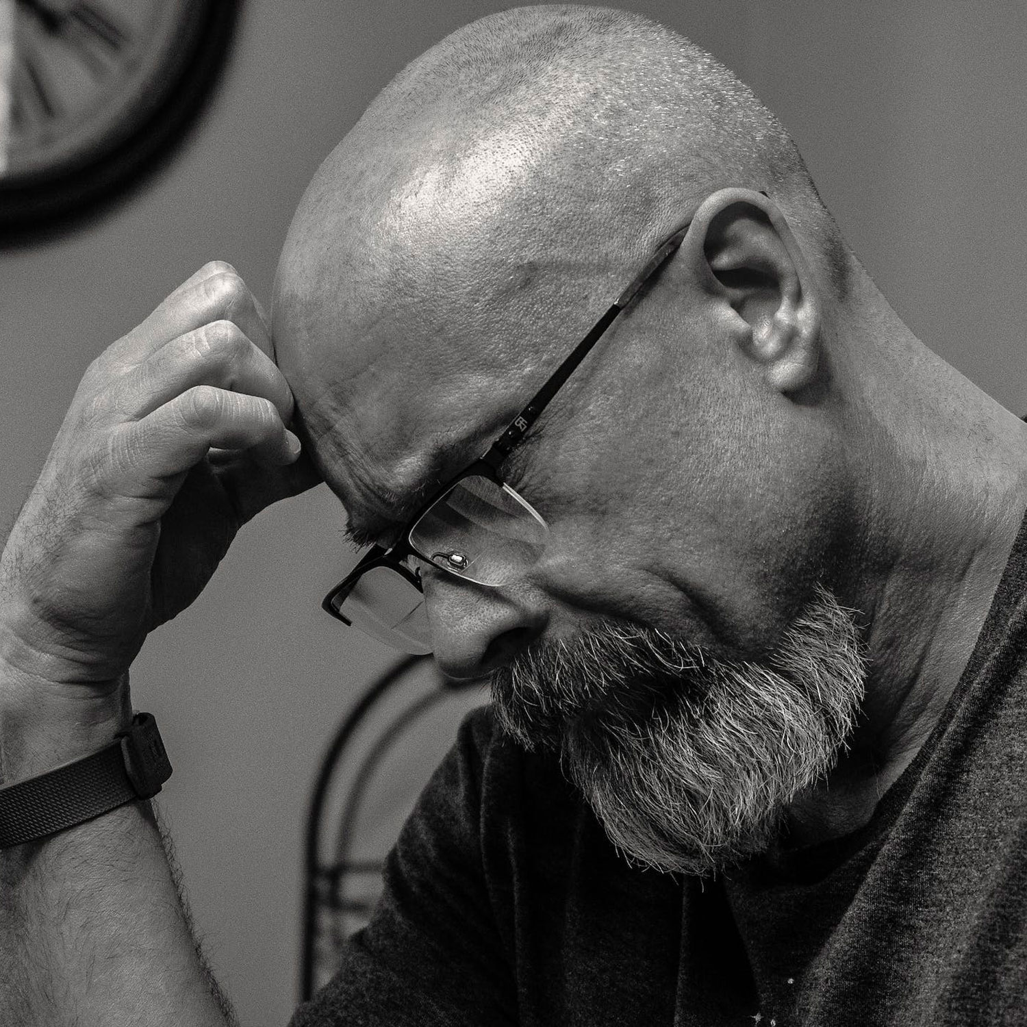 preparazione tricopigmentazione prima e dopo preparazione tricopigmentazione prima e dopo